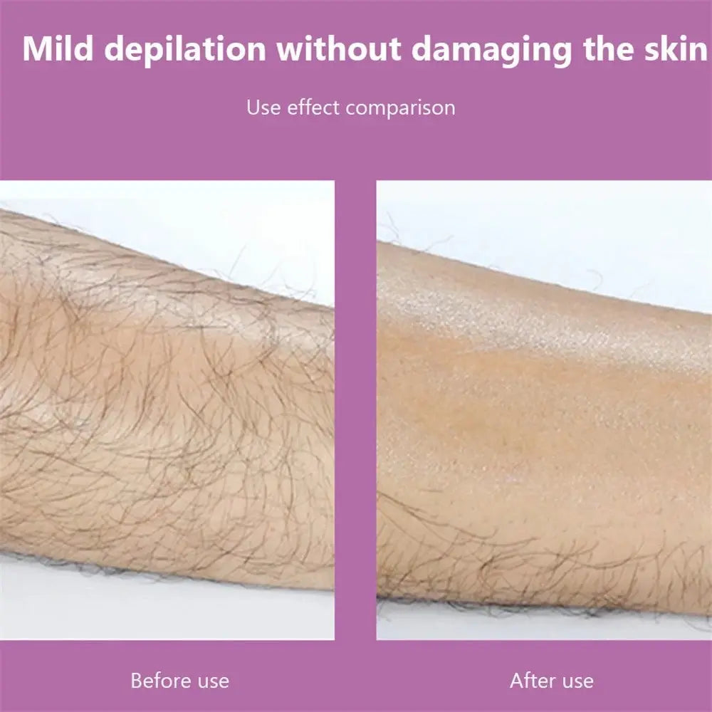 Hair Removal