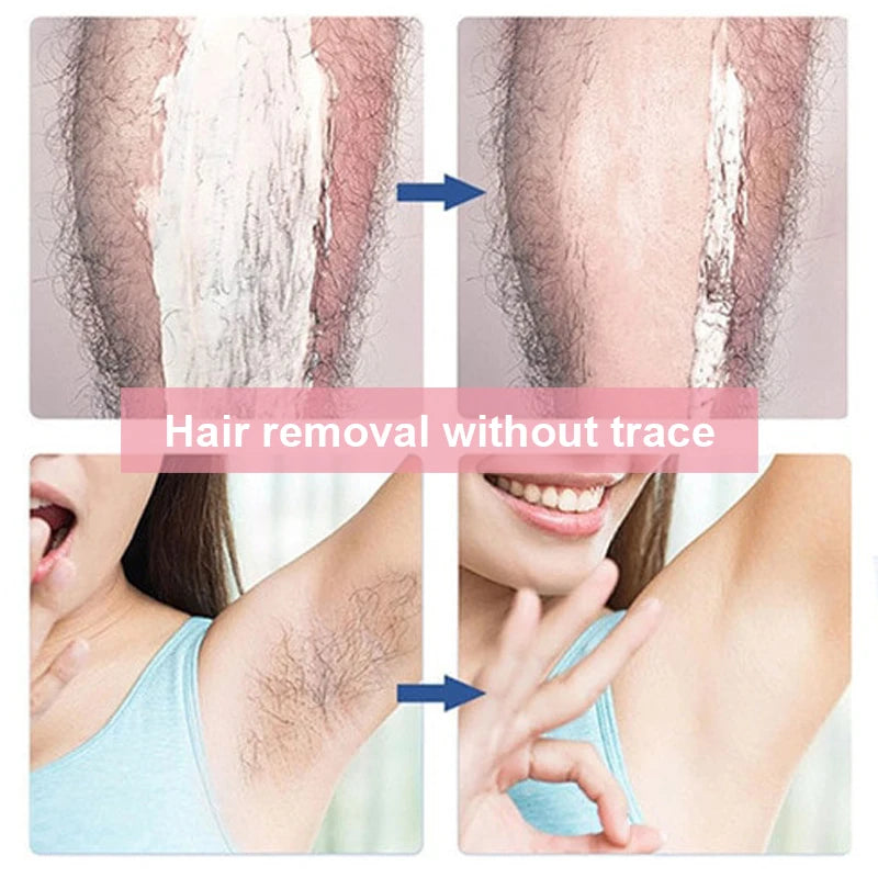 Hair Removal