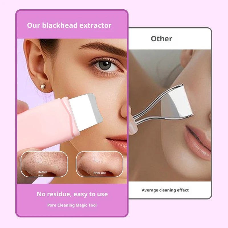 Double Headed Blackhead Removal