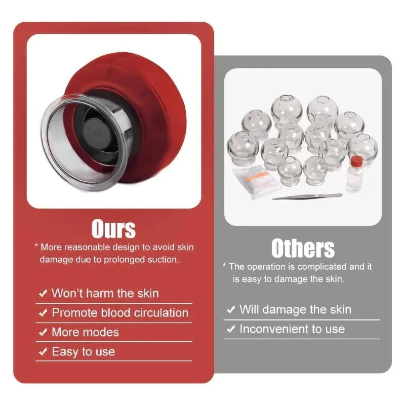 Electric Cupping Massage